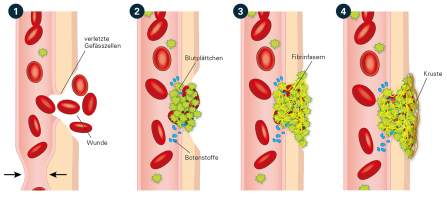 Abb. 8 Wundverschluss