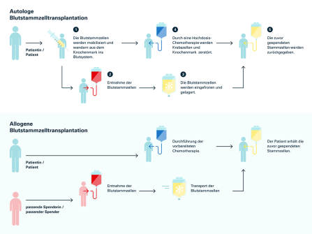 Abb. 3: Autologe und allogene Blutstammzelltransplantation im Vergleich. Quelle: Blutspende SRK Schweiz (2023)